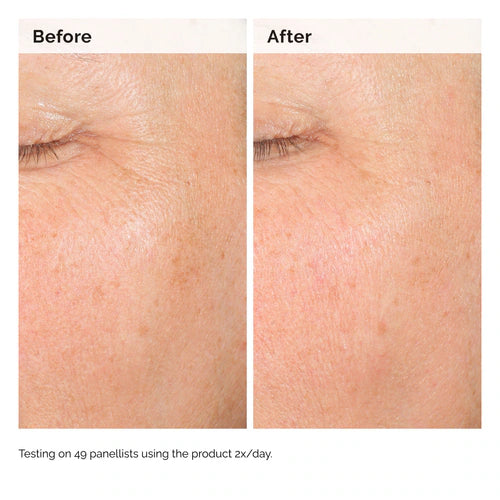 The Ordinary
Alpha Arbutin 2% + Hyaluronic Acid for Hyperpigmentation