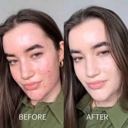 Dr.Jart+ Cicapair ™ Tiger Grass Color Correcting Treatment SPF 30